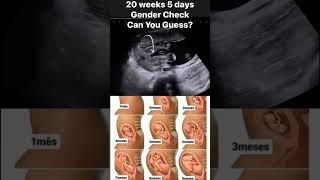 20 week 5 days baby guess the gender of baby