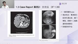 科研 SCI 发表之路：如何突破从 0 到 1