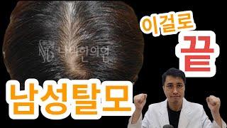 남성탈모 병원을 찾고 계신가요? 여기에서  남성탈모의 원인과 증상, 치료 방법을 알아보세요.  #남성탈모