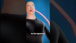 What Is A Tapeworm? 