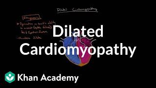 Dilated cardiomyopathy: Pathophysiology and diagnosis | NCLEX-RN | Khan Academy