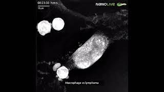 Macrophage vs lymphoma