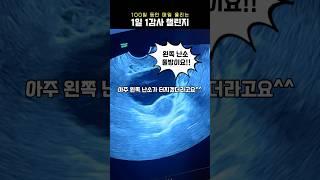 감사일기 50일차 #인공수정 #난임브이로그 #물혹 #자궁내막증 #난임부부 #임신준비 #감사일기