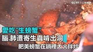 愛吃生螃蟹 腦.肺遭寄生蟲啃出洞｜三立新聞網SETN.com