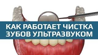 Ультразвуковая чистка зубов. Процедура проведения чистки зубов ультразвуком