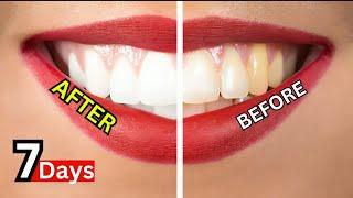 how to make natural teeth whitening