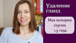 Удаление гланд. Моя история спустя 1,5 года | Анна Чижова