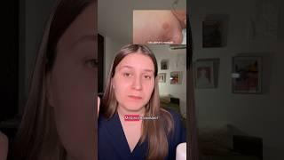 У новорождённого выделяется молоко из груди. Неонатальная галакторея. Ведьмино молоко.