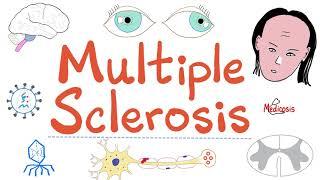 Multiple Sclerosis (MS) - Symptoms, Signs, Risk Factors, Diagnosis, Treatment - Autoimmune - Neuro