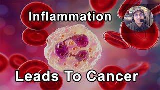 Inflammation Over Time Can Lead To Cancer -  Sunil Pai, MD