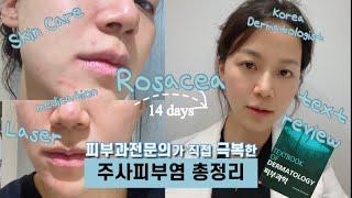 SUB)홍조, 여드름인 줄로만 알았던Rosacea, 주사피부염의 모든것ㅣ피부과전문의ㅣ스킨케어&병원치료