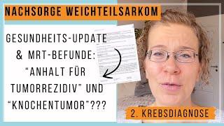 2. Krebsdiagnose Sarkom: Gesundheitsupdate & Nachsorge MRT Befunde: Tumorrezidiv? Knochentumor?