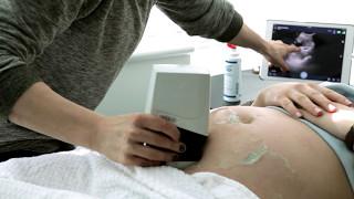 See how Clarius ultrasound is ideal for quick obstetric exams