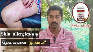 தோல் அரிப்பு, தோல் அலர்ஜி உடனடி நிவாரணம் இதோ | Quick Relief for Skin Allergy | NEXT DAY 360