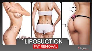 Liposuction Procedure Explained Step-by-Step Dr Vikas Gawri Ludhiana Punjab