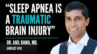 Sleep Apnea Diagnosis and Treatment - Dr. Anil Rama, MD | JawCast #61