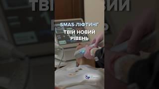 Апарати SMAS ліфтингу В НАЯВНОСТІ #smas #cosmetics #cosmetology