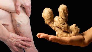 Ginger. No more leg pain, rheumatism, cramps, arthritis, joints.recipe