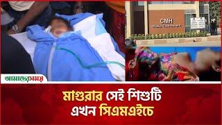 মাগুরার সেই শিশুটি এখন সিএমএইচে | Magura  | Child Rape Case | CMH | Amader Shomoy News