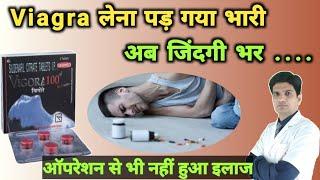 Viagra tablet overdose effects | Viagra side effects | Vigora overdose