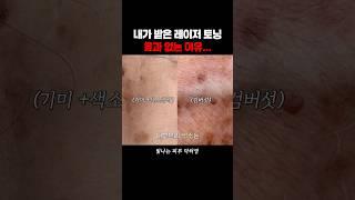 레이저토닝만 받으면 효과 없어요 #레이저토닝 #토닝 #잡티제거