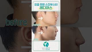 쥬베룩 보다 좋은 콜라겐 부스터? 레디어스의 모든 것 #레디어스 #콜라겐부스터 #쥬베룩