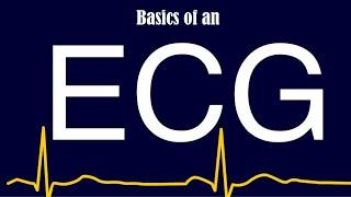 ECG basics