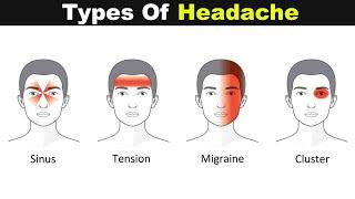 Different Types Of Headache | Sign,Symptomps and Treatments (Urdu/Hindi)