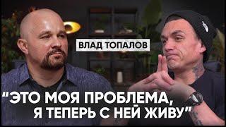 ИСПОВЕДЬ ВЛАДА ТОПАЛОВА. О ЧЕМ ПРИНЯТО МОЛЧАТЬ. И еще: о причинах распада SMASH! и ТРАВМАХ ДЕТСТВА