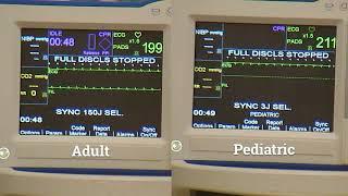 R Series Plus:  Synchronized Cardioversion