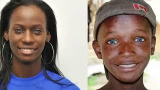 Why Some Africans with Blue Eyes!!!
