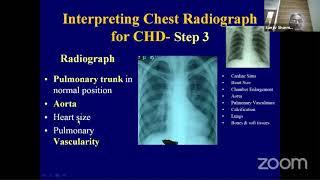 Chest X Rays in Congenital Heart Disease