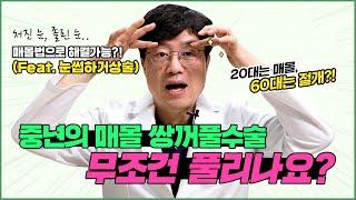 절개법VS매몰법 | 중년 쌍수는 무조건 절개?! 나한테 맞는 쌍꺼풀수술 방법은 이렇게 고르는 겁니다!! (양연모성형외과|의학박사 양연모)