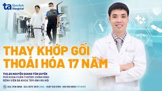 Thay khớp gối cho bệnh nhân thoái hóa khớp 17 năm | ThS.BS Nguyễn Quang Tôn Quyền| CTCH Tâm Anh