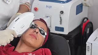 PHOTO FACIAL IN JAIPUR  | SKINATURE CLINIC | DR JYOTI THAGARIA