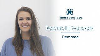 My Experience With Porcelain Veneers in Tijuana (Trust Dental Care)