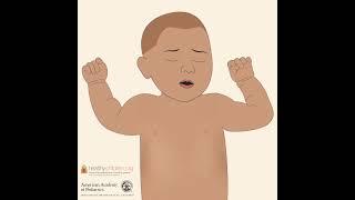 RSV: Signs & Symptoms in Babies | AAP #shorts