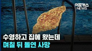 국내 최초로 '뇌 먹는 아메바' 감염 발생..증상은? / 이포커스