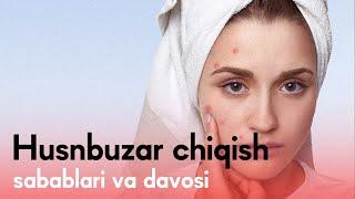 Husunbuzar chiqish sabablari  va davosi