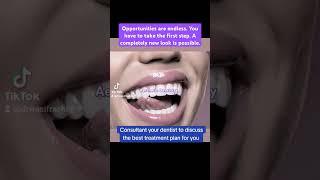 Dental Health Care| Dr. Wasif Rashid | #foryou  #dentist
