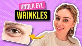 How to Treat Under Eye Wrinkles from a Dermatologist! | Dr. Shereene Idriss