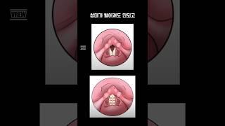 성대가 벌어져도, 꽉 붙어도 안됩니다! #성악발성 #발성법  #성악비법 #shorts
