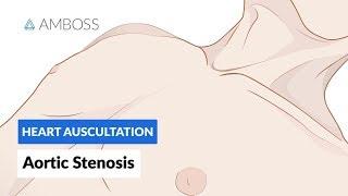 Aortic Stenosis (AS) - Heart Auscultation - Episode 1