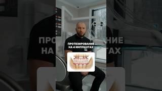 Если у вас НЕТ ЗУБОВ, что делать?  +7 (495) 432-05-18 Москва, Малая Филевская, 22