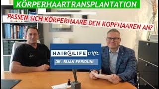 Körperhaartransplantation | BHT | Erfahrung | Passen sich Körperhaare den Kopfhaaren an? | Beratung