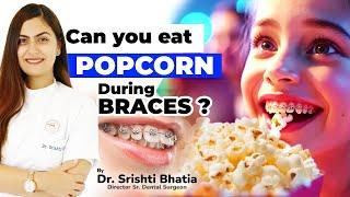 Kya Braces ke sath POPCORN kha sakte hain? Can you eat POPCORN during BRACES? Dr. Srishti Bhatia