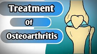 Osteoarthritis ka treatment kya hai? in hindi & English #osteoarthritis #jointpain