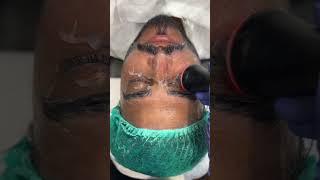 Hydra Treatment | MR Aesthetics | Dr Rizwan Malik |  #beautysecrets #youtubeshorts