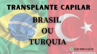 Transplante cabelo Brasil ou Turquia ? Não faça seu transplante de cabelo antes de ver este video !