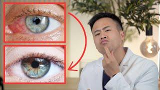 How I Finally Solved My Patient’s Red Eyes | 3 Tips